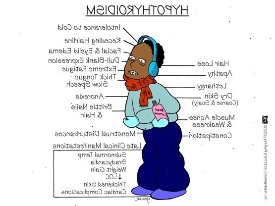 Hypotyreose. hva er hypotyreose? Hypotyreose. hva er hypotyreose?