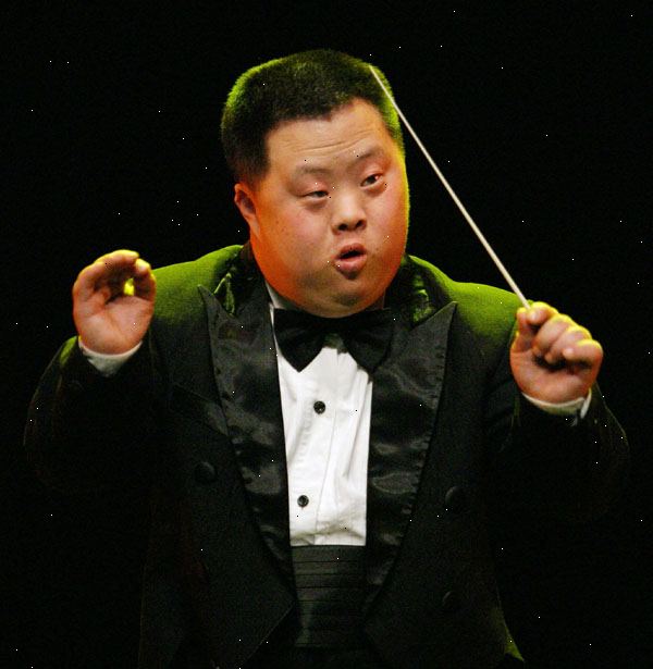 Downs syndrom. det som er Downs syndrom? Downs syndrom. det som er Downs syndrom?