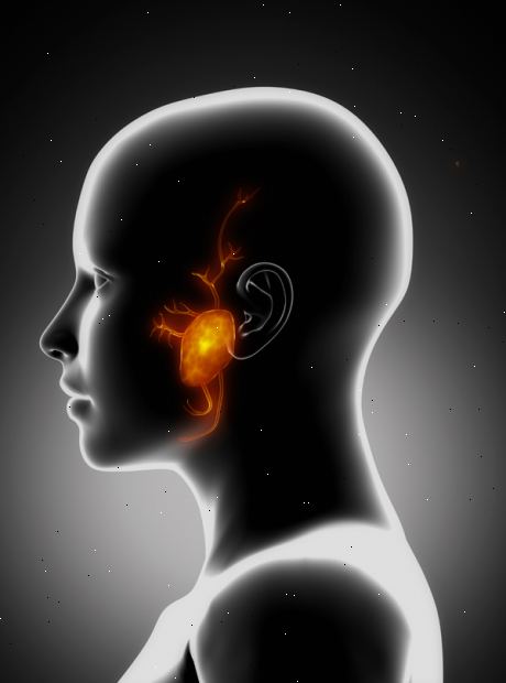 Parotid kjertel fjerning - parotidectomy. etter andndash; på sykehus. Parotid kjertel fjerning - parotidectomy. etter andndash; på sykehus.