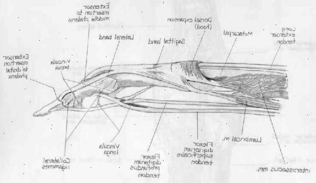 Sene reparasjon - extensor. etter andndash; på sykehus. Sene reparasjon - extensor. etter andndash; på sykehus.