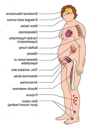 Cushings syndrom. det som er Cushings syndrom? Cushings syndrom. det som er Cushings syndrom?