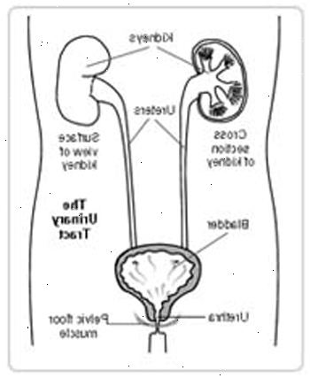 Ureterolithotomy - dormia kurv. etter andndash; på sykehus. Ureterolithotomy - dormia kurv. etter andndash; på sykehus.