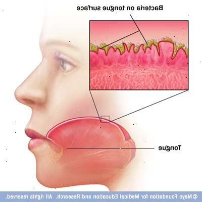 Dårlig ånde (halitosis). hva som forårsaker dårlig ånde? Dårlig ånde (halitosis). hva som forårsaker dårlig ånde?