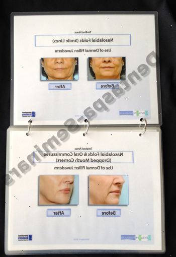 Pasient casebook: christine. Hovedpunktene i denne saken. Pasient casebook: christine. Hovedpunktene i denne saken.