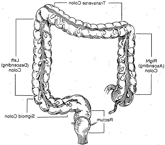 Polypper i tykktarmen (tykktarmen). hva er en colonic polypp? Polypper i tykktarmen (tykktarmen). hva er en colonic polypp?