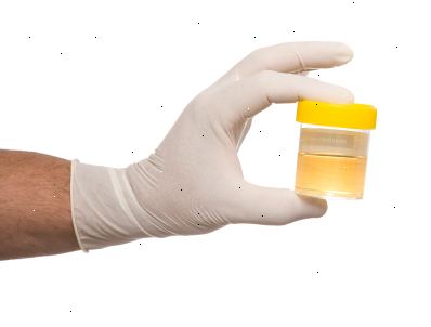 Urinprøve. når er en urinprøve som trengs? Urinprøve. når er en urinprøve som trengs?