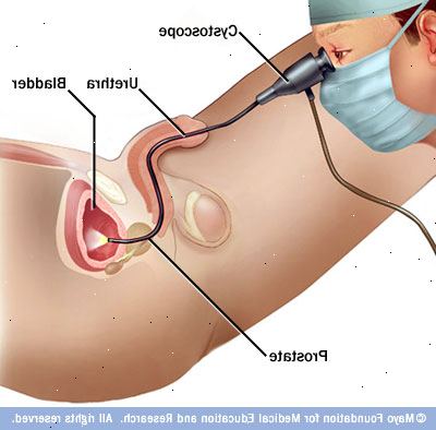 Cystoskopi. hva er en cystoskopi? Cystoskopi. hva er en cystoskopi?