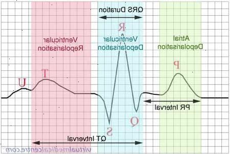 EKG (elektrokardiogram). hva er hvile-EKG brukes til? EKG (elektrokardiogram). hva er hvile-EKG brukes til?