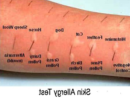 Allergi tester. RAST-test. Allergi tester. RAST-test.