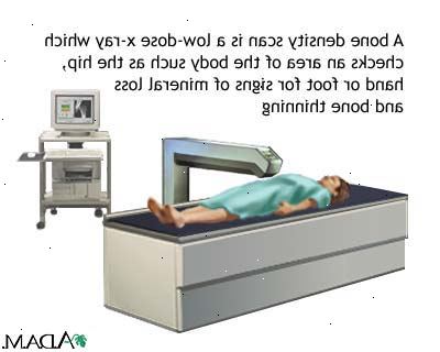 Bentetthet skanner for osteoporose. hva er beintetthet skanner? Bentetthet skanner for osteoporose. hva er beintetthet skanner?