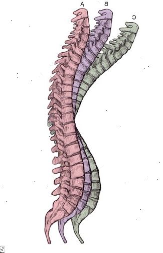 Osteoporose: forebygge fall. hvorfor forebygge fall hjemme? Osteoporose: forebygge fall. hvorfor forebygge fall hjemme?