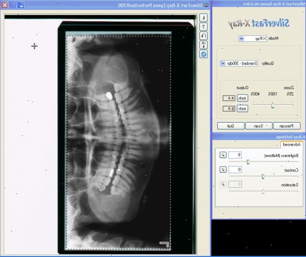 X-stråler. ansatte som er involvert i x-ray tester og behandling. X-stråler. ansatte som er involvert i x-ray tester og behandling.