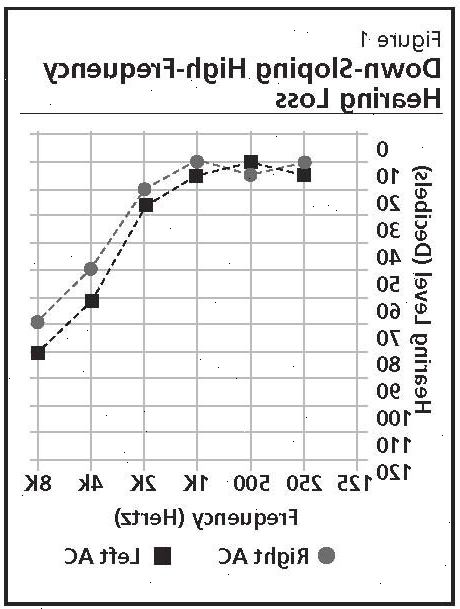 Aldersrelatert hørselstap (presbyacusis). hva er årsakene til hørselstap? Aldersrelatert hørselstap (presbyacusis). hva er årsakene til hørselstap?