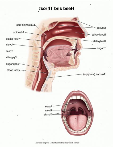 Laryngitt. hva som forårsaker laryngitt? Laryngitt. hva som forårsaker laryngitt?