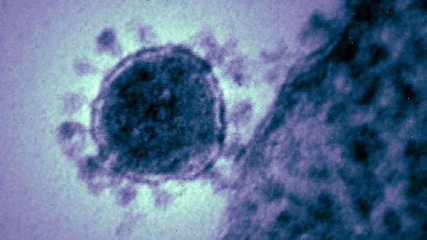 Coronavirus. hva er coronaviruses? Coronavirus. hva er coronaviruses?