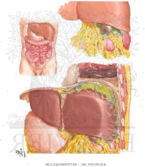 Abscess subfreniske. etter andndash; på sykehus. Abscess subfreniske. etter andndash; på sykehus.