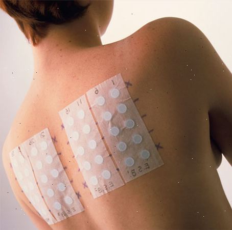 Patch testing for hud allergier. hva er patch testing? Patch testing for hud allergier. hva er patch testing?