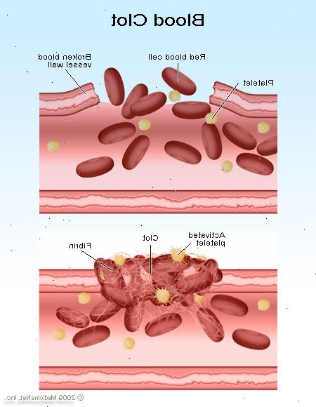 Trombocytopeni (redusert antall blodplater). falsk trombocytopeni. Trombocytopeni (redusert antall blodplater). falsk trombocytopeni.